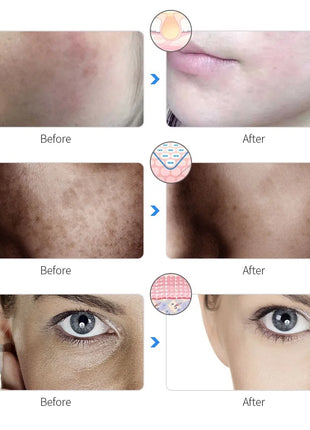 Rechargeable Facial LED Mask 7 Colors LED Photon Beauty Mask Skin Rejuvenation Home Face Lifting Whitening Skin Care Beauty Mask