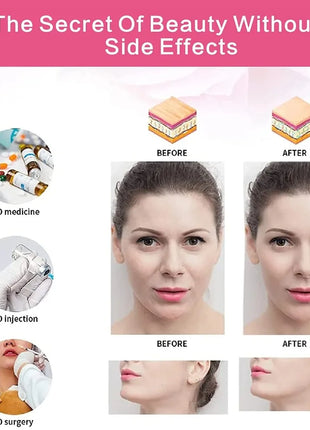 YS00135--Elastic face slim bandage v line facial shape woman chin belt facial care beauty tool